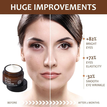 IREV Retinol Eye Cream (pack of 2)